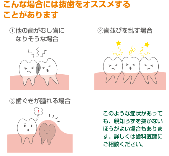 抜歯をおすすめする場合